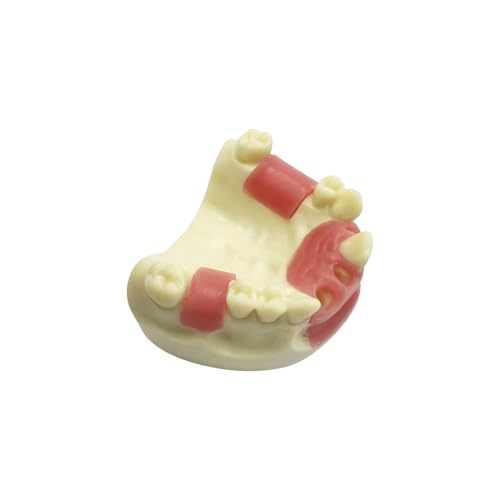 Dental Implant Practice Model, YOUYA DENTAL Maxillary Sinus Implant Model Dental Mandibular Sinus with Soft Gums for Dentist Student Studying Teaching Training Teaching Demonstration Clinic Model Maxillary Anterior Teeth Model
