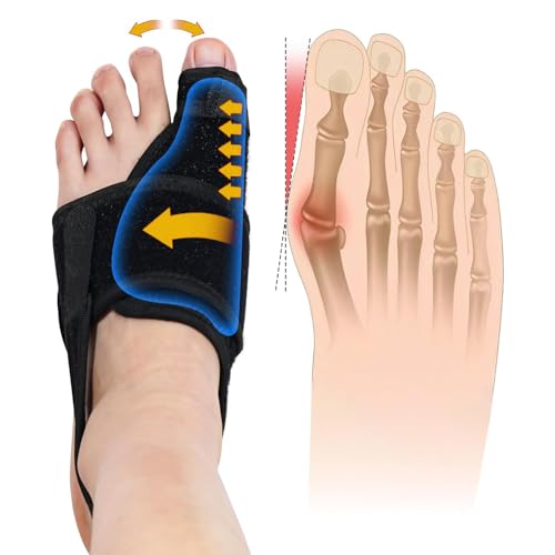 Bunion Corrector for Women & Men, Orthopedic Bunion Splint for left (Black)