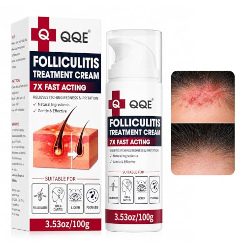 Benzoyl Peroxide Folliculitis Cream, Anti Itch Cream Extra Strength, Fast-Acting Acne Cream for Folliculitis, Razor Bumps & Ingrown Hair, Itch Cream, Psoriasis Scalp Treatment, 3.53 Oz