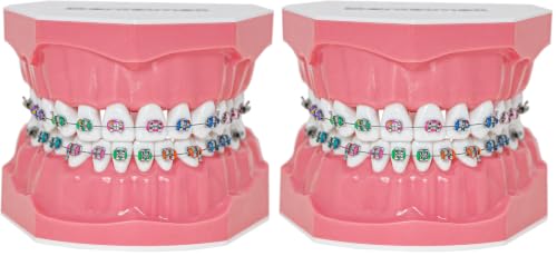 Typodonts Orthodontics Demonstration Model with Metal Wires and Bracket Teaching, Learning, Interpretation Model for Adults and Children (Metal Bracket) (Pack of 2) 7010-2 (Pack of 2)