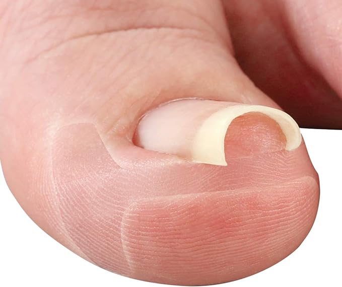 Cyprus Transparent Wrap Nail Tape, Thin Transparent Plate, Double Layered Construction, Transparent Tape, Not Conspicuous, Miene -  Australia
