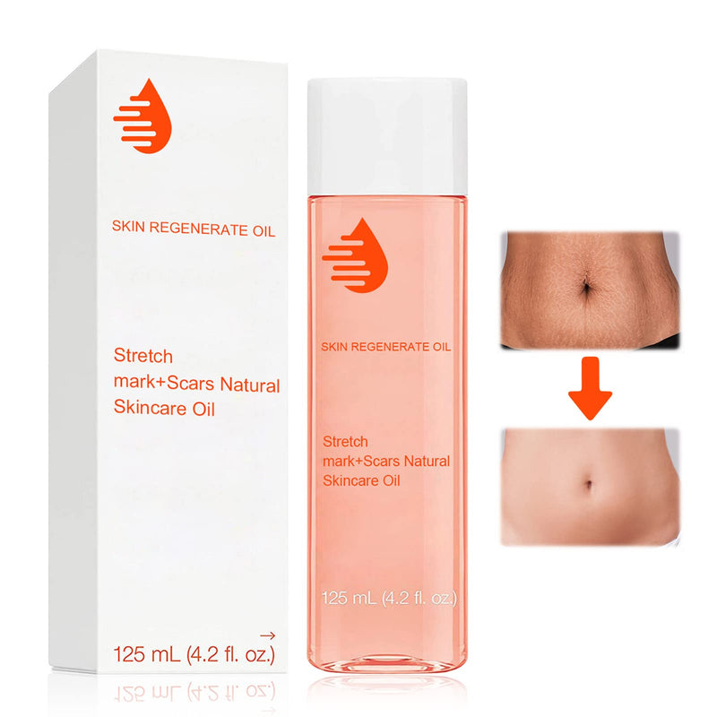 Stretch Mark Oil Pregnancy, Stretch Marks Removal, Collagen Boost Firming & Lifting Skincare Oil, Body Oil for Women, Prenatal and Post Partum Care Help Us Women Get Rid of Stretch Marks, 125 ml - BeesActive Australia