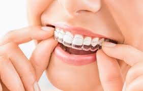 Teeth Whitening Kit KAV PLUS Professional Tooth Whiten Gel Dental Care Home Bleaching Kit for White Teeth Including 6 Teeth Whitening Gel with Crest 3D White Toothpaste - BeesActive Australia