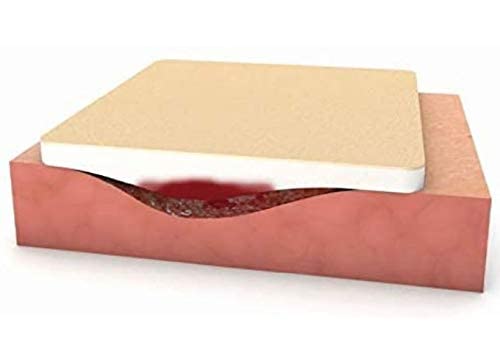 PU Foam Dressing (Moderex Non Adhesive) for Heavily exuding Wounds (15x15cm x 10) 15x15 cm (Pack of 10) - BeesActive Australia