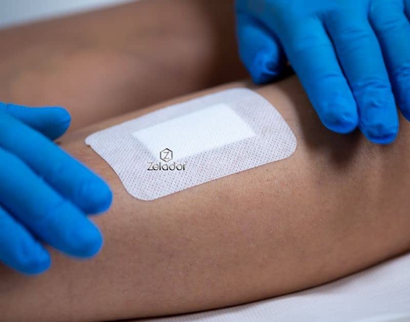 Moderex Sterile Adhesive Island Dressing with Absorbent Cotton Pad (6x7cm x 25) 6x7cm x 25 - BeesActive Australia