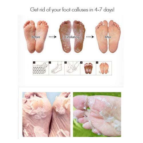 Purederm Exfoliating Foot Mask - Peels Away Calluses and Dead Skin in 2 Weeks! (3 Pack (3 Treatments), Regular) - BeesActive Australia