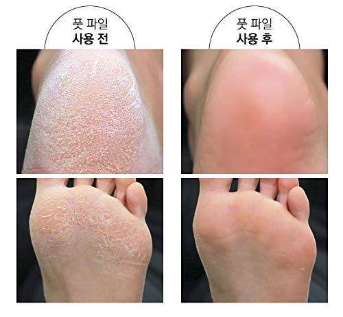 BodyBogam Glass Foot File /Pedicure Callus Remover for Smooth Soft Feet , Glass Foot Scraper File - BeesActive Australia