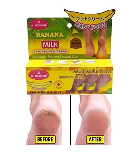 Cracked Heel Cream A bonne Banana Milk Rescue your feet Eliminate dry skin, Cracked skin 50 g. - BeesActive Australia