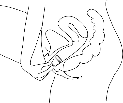 Funmicup No-stem Anatomic Menstrual Cup Period Cup for Those Who Have Had Vaginal Births - Flexible and Reusable Menstrual Cups - Large - BeesActive Australia