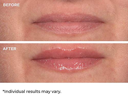 NassifMD Hydro-Screen for Lips - BeesActive Australia