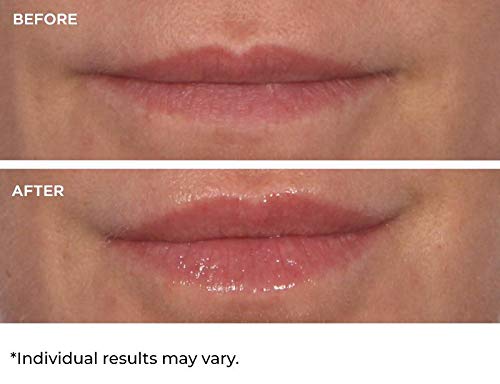 NassifMD Hydro-Screen for Lips - BeesActive Australia