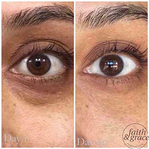 Anti Aging Under Eye Cream for Improving Dark Circles, Fine Lines and Puffiness. Under Eye Bags Treatment Reduce Breakdown of Collagen, Soothe and Rejuvenate for a Healthy Youthful Appearance (USA) EyeCream - BeesActive Australia