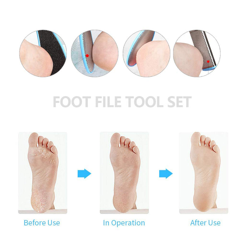 Foot Files Set Tools, Professional Pedicure Kit, Foot Skin Care Tool Set for hard skin Double-Sided Files Exfoliating Prevent Dead Skin Salon Pedicure Kit 11 in 1 - BeesActive Australia