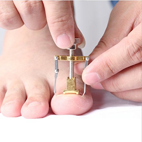 Ingrown Toenail Lifter Correction Tools Paronychia Toe Nail Treatment Corrector Recover Foot Nail Care Pedicure Tool with one pair of Toe Separators - BeesActive Australia