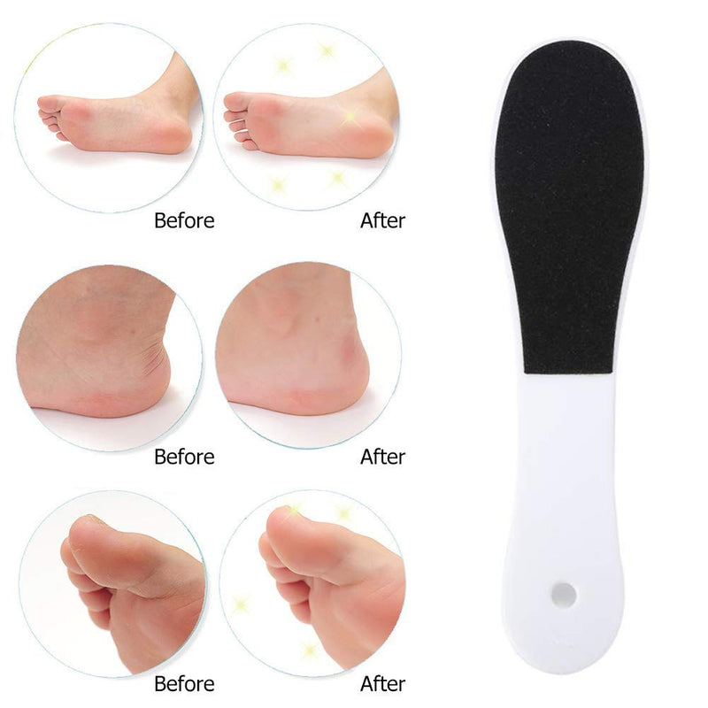 Foot File Hard Skin Remover, Double-Sided Foot Files Pedicure, Professional Foot Care Tool for Dead Skin and Dry Cracked Feet Scraper, Foot Scrub Foot Exfoliator Foot Scraper Foot Rasp (1pcs) 1 Count (Pack of 1) - BeesActive Australia