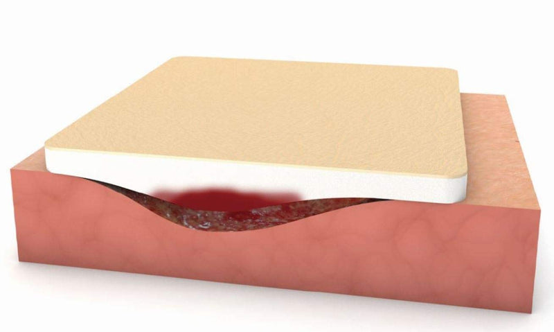 Moderex Border Absorbent Foam Dressing with Adhesive Border for Leg lucers/Diabetic Foot ulcers/bedsores, Sterile 15x15cm. The Adhesive Border is 2.5cm so The Absorbent pad is 12.5x12.5cm 15x15 cm (Pack of 10) - BeesActive Australia