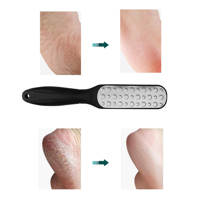 Kayer Foot File Scraper,304 Stainless Steel Pedicure Rasp,2 Modes Foot Scrubber,Callus Remover Suitable for Wet and Dry Feet (Black) - BeesActive Australia