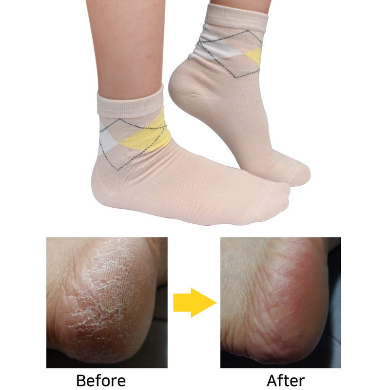 Moisturizing Socks - Gel Heel Sleeves for Dry Cracked Feet – Silicone Spa Socks (Nude) - BeesActive Australia