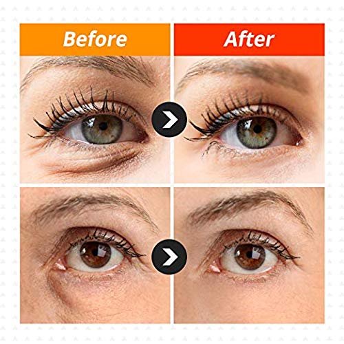 [Bellalussi]Ultra Repair Snail Eye Cream for Eye and Facial Reduce Dark Circle/Crow Feet & Anti-wrinkle with Snail/Herb - BeesActive Australia