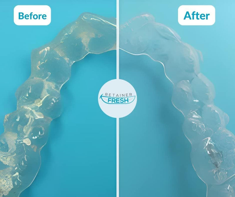 Retainer Cleaning Tablets - 120 Tablets 4 Months Supply Retainer Fresh, Brite, and Stain-Free - Retainer Cleaner Tablet, Mouth Guard, Dentures, Aligners 120 Count (Pack of 1) - BeesActive Australia