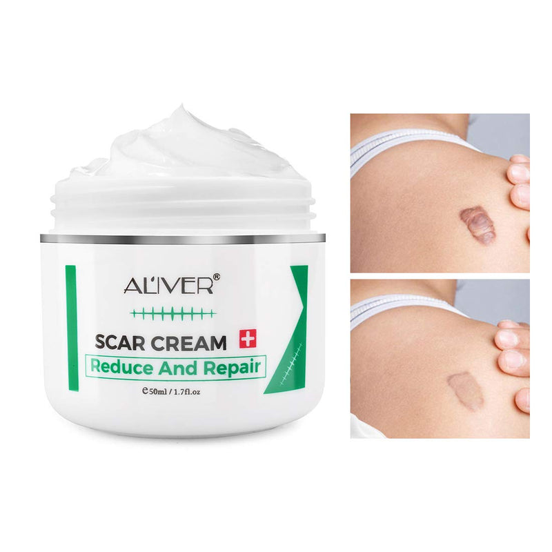 Scar Removal Cream, Stretch Marks Remover Cream, Acne Scar Treatment for Face, Scar Cream for Surgical Scars, Burns on Legs, Arm -1.7 Fl.oz - BeesActive Australia