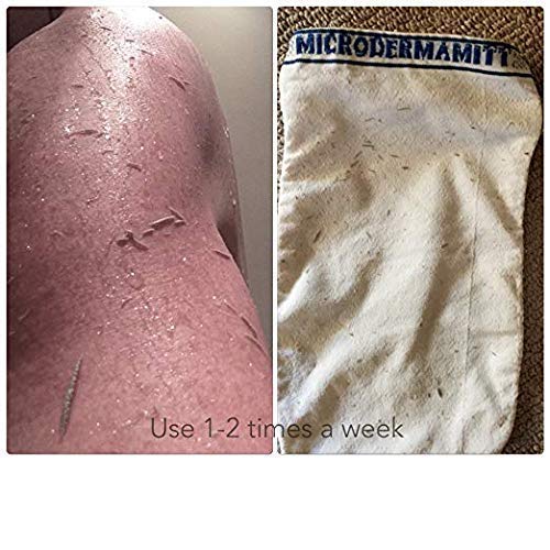 MicrodermaMitt Deep Exfoliating Mitt Body Scrub – Dead Skin Remover Treatment For Smooth Skin, Keratosis Pilaris Treatment & Improved Skin Texture Body Mitt - BeesActive Australia