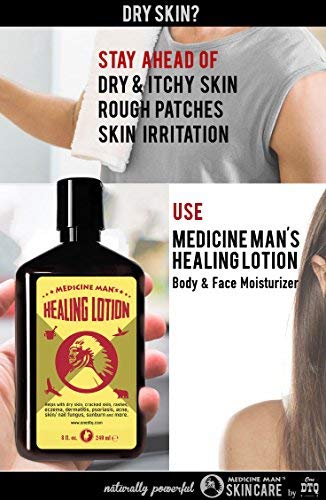 Medicine Man’s Healing Body Lotion - Tea Tree Oil Moisturizer - Natural and Organic, Dermatitis, Psoriasis, Anti Acne Treatment - 8 Ounces - for Dry, Itchy, Scaly Skin - BeesActive Australia