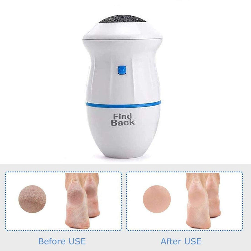 Electric Adsorption Foot Grinder, Pedicure Foot Care Tools, Speed Callus Remover for Dead Hard Cracked Dry Skin (Foot Grinder White) - BeesActive Australia