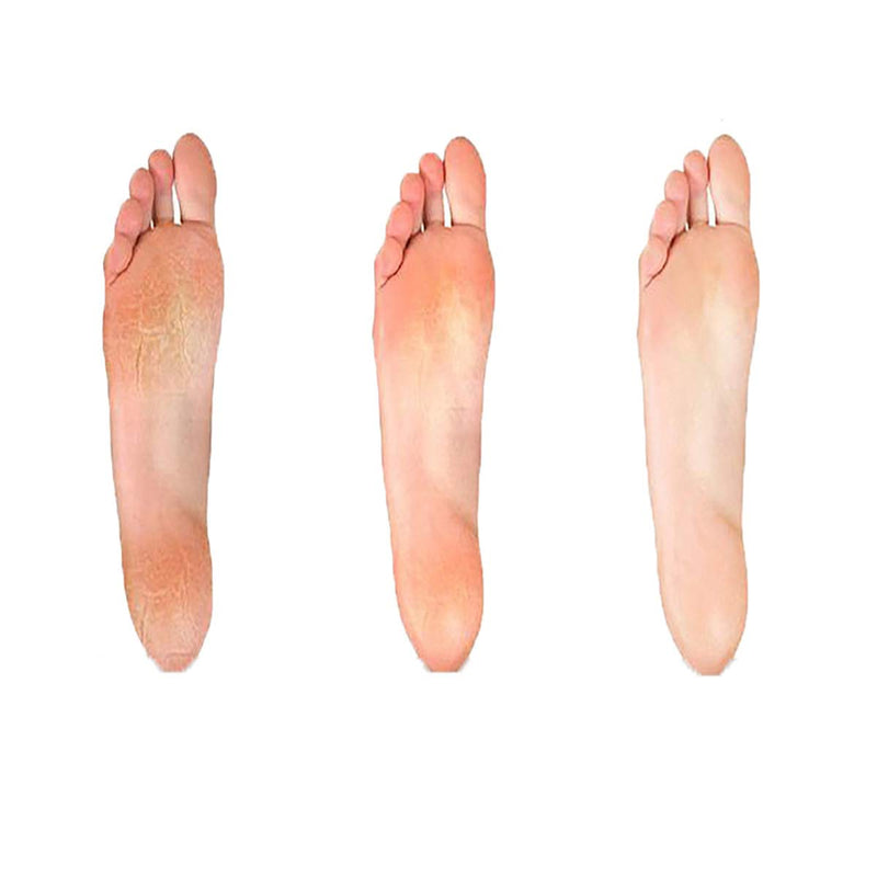 Dr.Pedi Foot Files Callus Remover Professional Pedicure Tools Foot Rasp File Pedicure Callus Remover Hard Dead Skin Scrubber Tika Foot Scraper with 3 Pcs - BeesActive Australia
