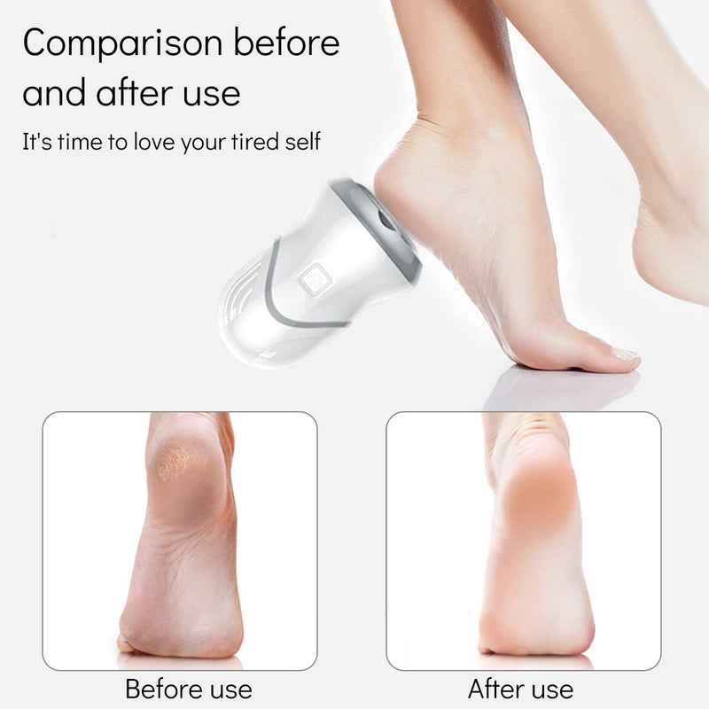 Electric Foot Grinder Adjustable Foot File Electric Pedicure Callus Remover Vacuum Adsorption Electric Foot Grinder Hard Skin Remover for Dead Dry Skin and Cracked Heel USB Rechargeable for Women Gift - BeesActive Australia