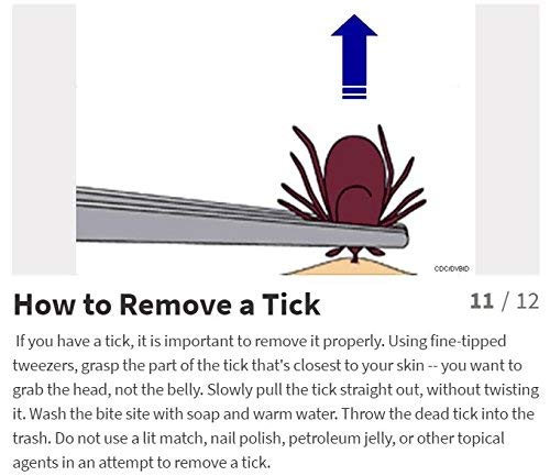 eTradewinds Tick Remover Tool | Tick-Off Pro | Hygienic All Stainless Steel Tick Removal Tool with Leather Case 2-Pack - BeesActive Australia