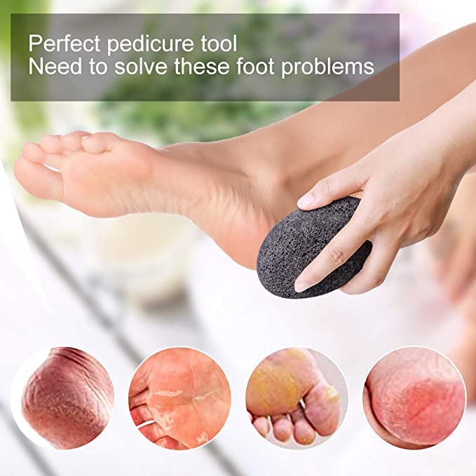 Natural foot pumice, hard skin remover for feet - foot scrub for removing dead skin - natural foot file and stratum corneum remover for removing skin keratin(black) (2 pcs foot files) 2 pcs foot files - BeesActive Australia