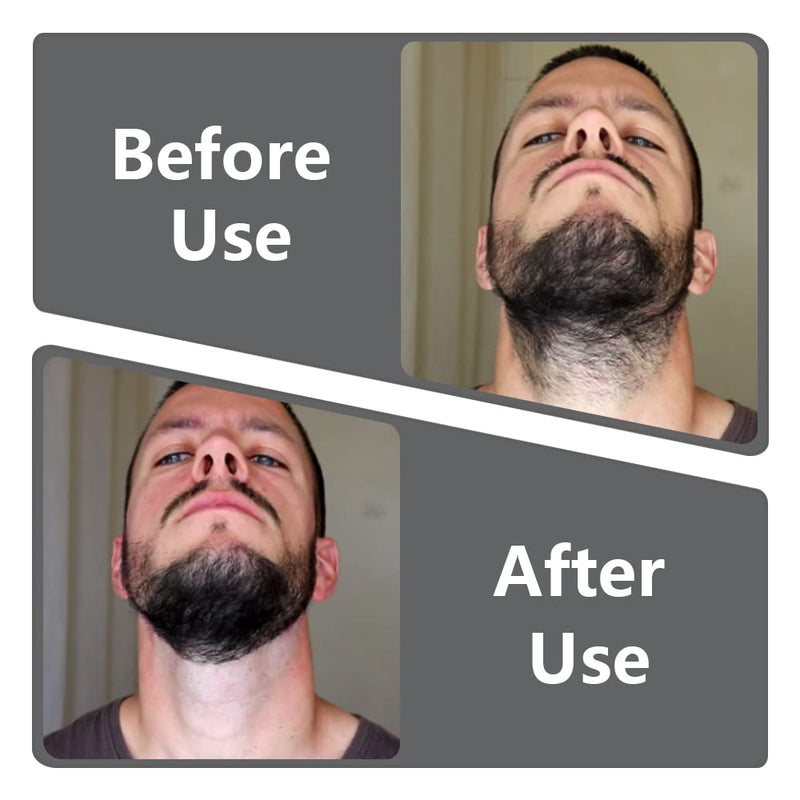 3 Pcs Beard Neckline Guide Beard Shaper Beard Trimming Tool for DIY Shaving and Keeping Neckline Haircuts - BeesActive Australia