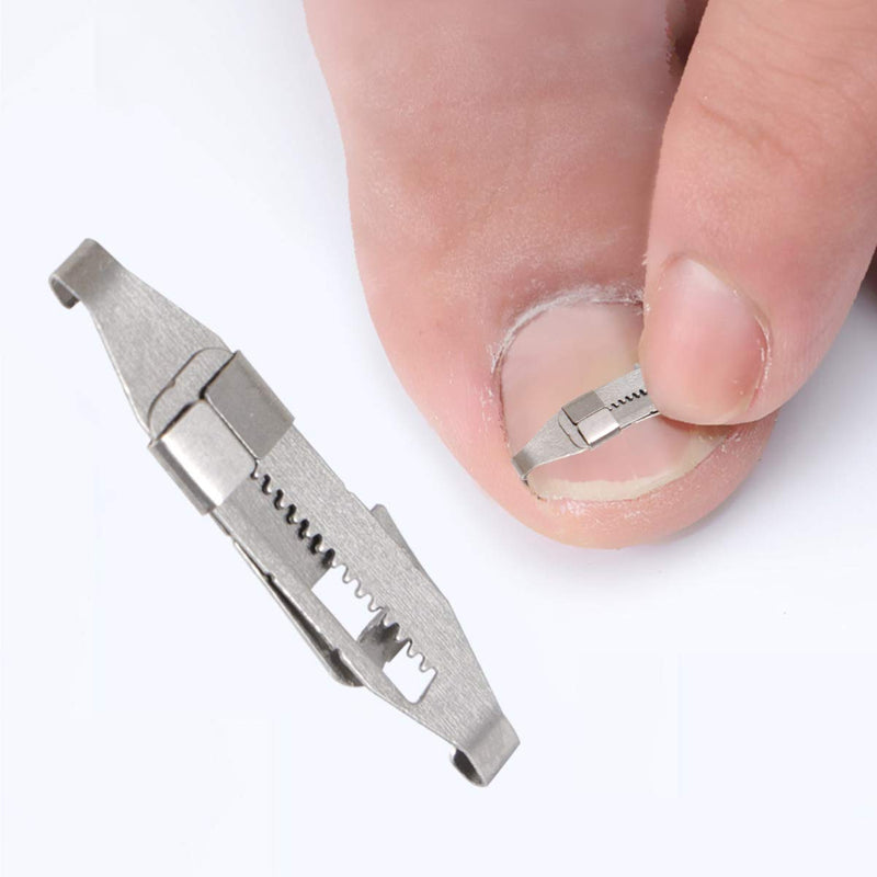 Exceart Toenails Correction Stainless Steel Clip Buckle Ingrown Toenail Tool for Men Women 1pc - BeesActive Australia