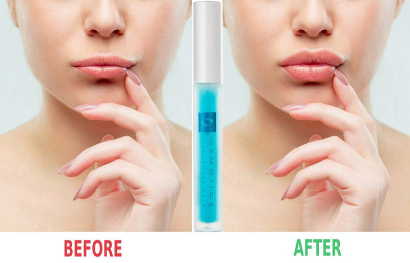 Osmotics Lip Plumper, Best Natural Lip Enhancer, Lip Gloss With Hyaluronic Acid, Hydrating, High Shine, Increase Lip Elasticity, Get Fuller & Hydrated Youthful Sexy Looking Lips A Natural Lip Enhancer - BeesActive Australia