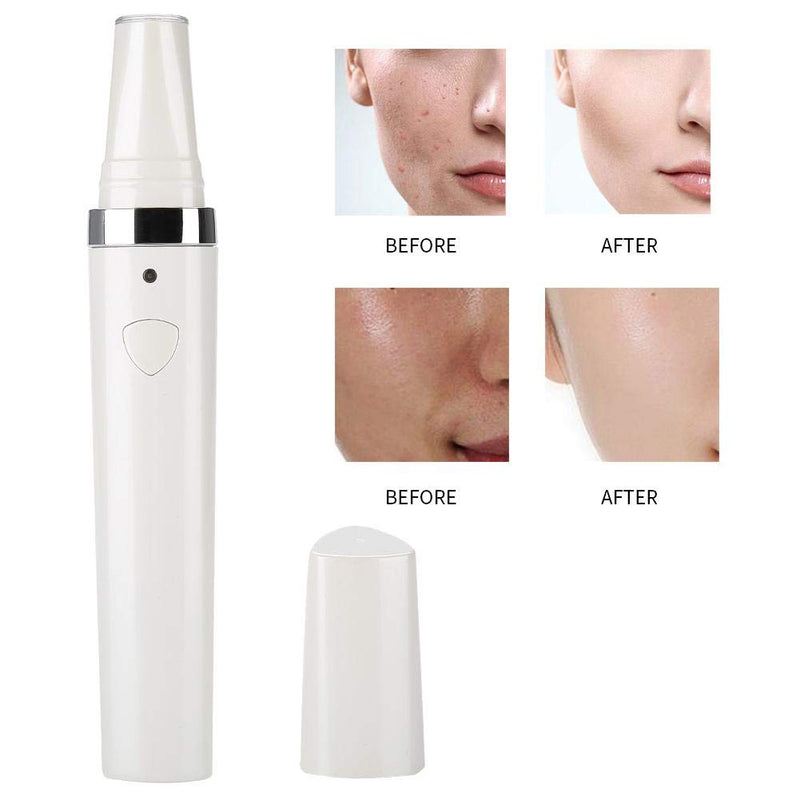 3 IN 1 Acne Removal Pen for Scar Repair Skin Rejuvenation Machine Acne Treatment Tool for Man and Woman - BeesActive Australia