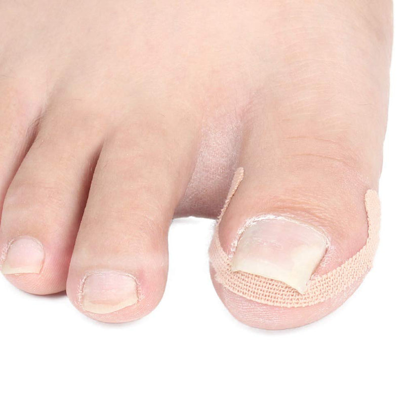 Pedicure patch Nail Toe Teratment Recovery Corrector Foot Care Tool Paronychia Ingrown toenails Pedicure Sticker Pedicure tools - BeesActive Australia