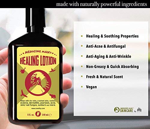 Medicine Man’s Healing Body Lotion - Tea Tree Oil Moisturizer - Natural and Organic, Dermatitis, Psoriasis, Anti Acne Treatment - 8 Ounces - for Dry, Itchy, Scaly Skin - BeesActive Australia