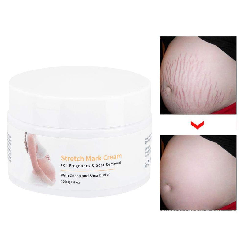 Stretch Mark Cream, Postpartum Obesity Cream, Remove Stretch Marks, Repair Scar Slack Line Abdomen Stretch Marks Postpartum 120g - BeesActive Australia