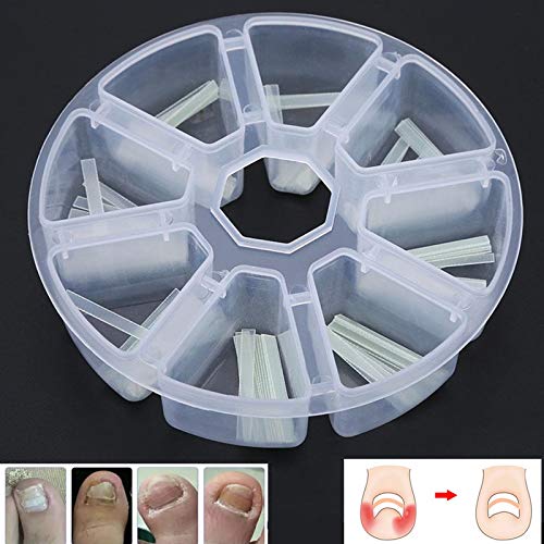 【𝐄𝐚𝐬𝐭𝐞𝐫 𝐏𝐫𝐨𝐦𝐨𝐭𝐢𝐨𝐧 𝐌𝐨𝐧𝐭𝐡】Toe Ingrown Pedicure Straightening Sticker Clip 120pcs/box Ingrown Pedicure Toenail Straightening Clip Toe Nail Sticker Patch Correction Tool - BeesActive Australia