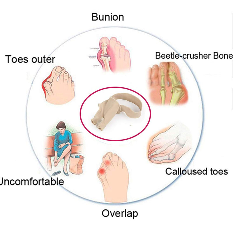 Bunion Straightener Protector Relief Sleeve w/Gel Bunion Stretchy Pads Cushioned Splint, Orthopedic Hallux Valgus Overlapping Corrector Bootie Guard Hammer Toe Pain Aid Surgery Treatment 2 Pc (S) S (Pack of 2) - BeesActive Australia