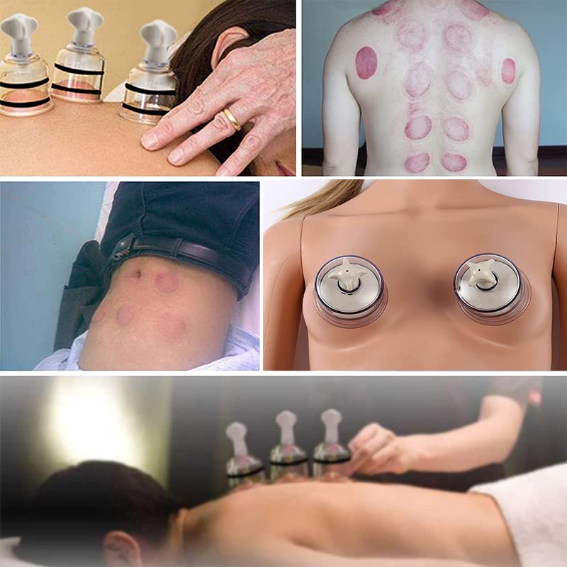 Npple Sucker,2PCS Cupping Set,Vacuum Twist Suction Cupping Device for Relaxation Pain Relief 2.5cm S(2.5) - BeesActive Australia