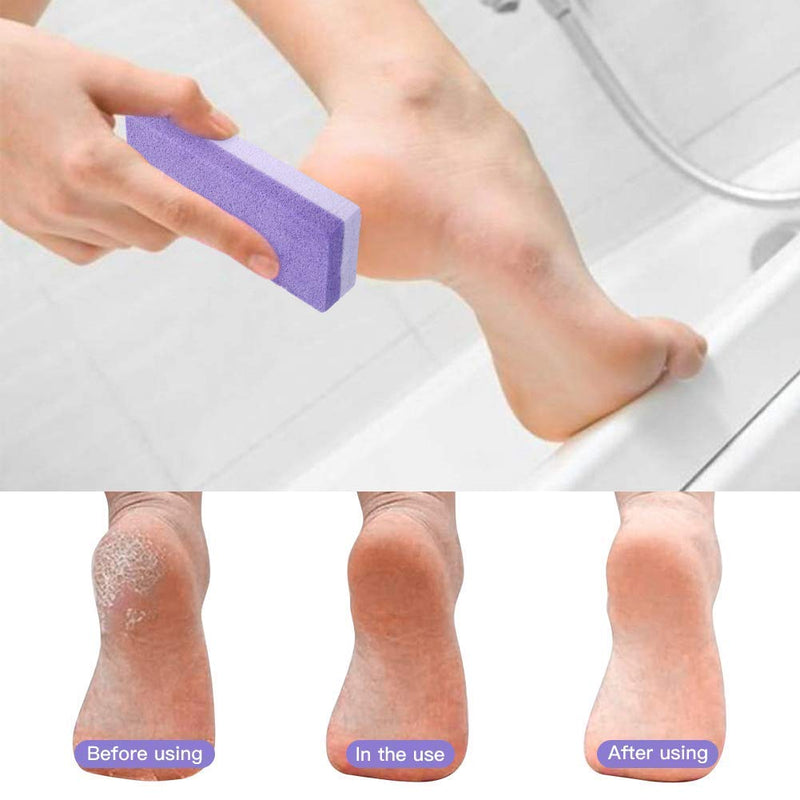 Foot Exfoliator Pedicure Tool Callus Remover Scrubber Skin Cleaner (Purple) - BeesActive Australia