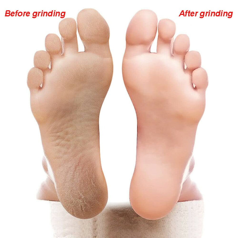 Double-Sided Foot File, 6pcs Foot Rasp Files Disposable Foot Rasp Manicure File Callus Hard Skin Remover - BeesActive Australia