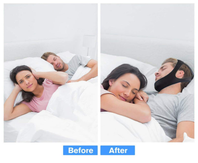 Anti Snoring Chin Strap Stop Snoring Aids Breathable Stop Snore Chin Strap Snoring Solution Snore Stopper Adjustable Anti Snoring Belt Stop Snoring Device for Men, Women, CPAP Users, Mouth Breather Black - BeesActive Australia
