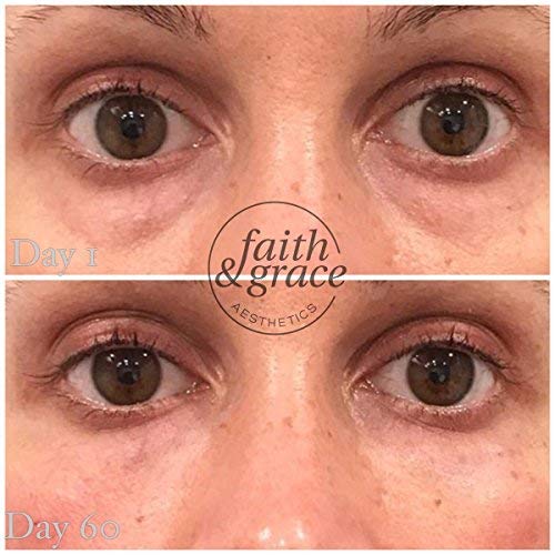 Anti Aging Under Eye Cream for Improving Dark Circles, Fine Lines and Puffiness. Under Eye Bags Treatment Reduce Breakdown of Collagen, Soothe and Rejuvenate for a Healthy Youthful Appearance (USA) EyeCream - BeesActive Australia