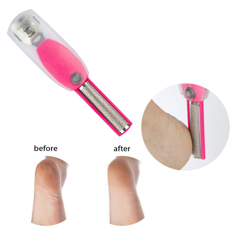 Foot File Callus Remover - 2 Pcs Stainless Steel Pedicure Kit Professional Exfoliation Calluses - Double Sided Files Foot Care Kit For Home, Hotels,Dorm Room，Beauty Salons And Daily Use 2 piece set - BeesActive Australia