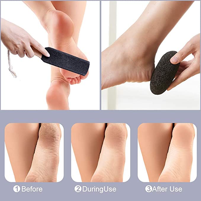 Natural foot pumice, hard skin remover for feet - foot scrub for removing dead skin - natural foot file and stratum corneum remover for removing skin keratin(black) (2 pcs foot files) 2 pcs foot files - BeesActive Australia
