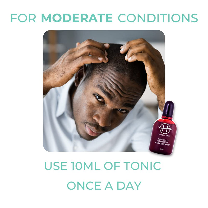 Herbal Hair: Hair Cleanse Oil | Advanced Herbal Tonic | Natural Ingredients | Hair Loss Treatment | Hair Recovery | Strengthen Hair | 120ml - BeesActive Australia