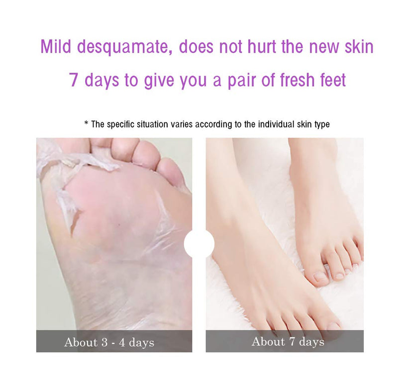 Exfoliating Foot Peel Mask For Peeling Away Cracked Heels, Dead Skin & Calluses Removes Repair Rough Heels, Get Silky Soft Feet Pack of 2 Pair - BeesActive Australia